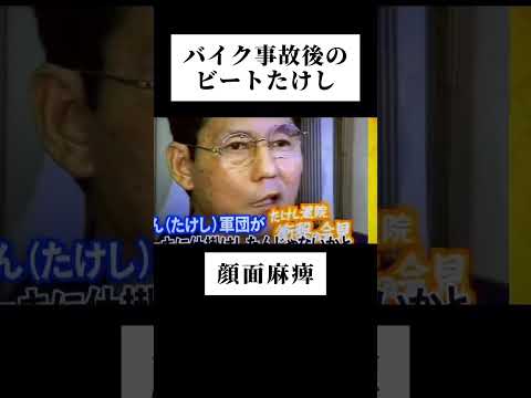 【顔面麻痺】バイク事故後のビートたけし #shorts #wassa1gou