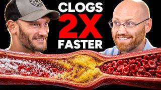 This 28,000 Person Study Found the Main Driver of Heart Disease and Plaque (Artery Doctor)