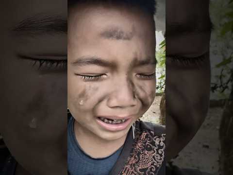Cậu Bé Bị Gì Ghẻ Hành Hạ – Cuộc Sống Khổ Đến Đau Lòng Khiến Ai Cũng Rơi Nước Mắt!#lykabun #funny