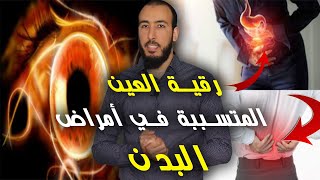 رقية اخراج العين المتسببة في تمريض البدن وفك عقد العين الحاسدة بإذن الله 