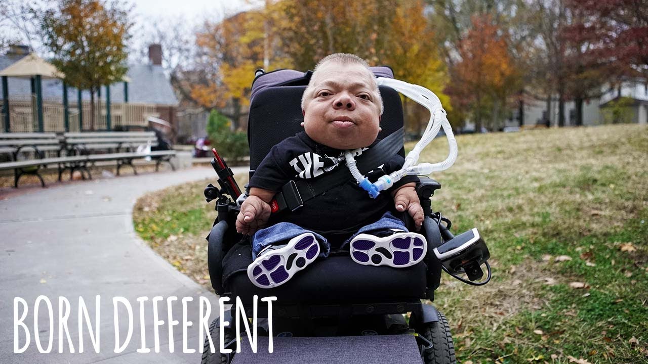 I'm the oldest person in the world with my condition - born different