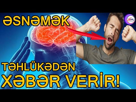 Əsnəmək təhlükəli xəstəlikdən xəbər verir – DİQQƏT!