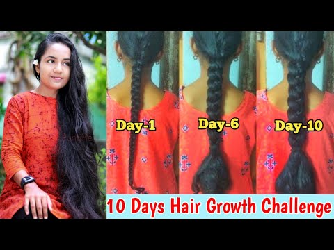 10 Days Super Fast Hair Growth Challenge- Before & After | Grow The Longest Hair In Monsoon| RuntiMe