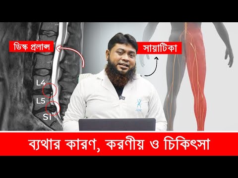 সায়াটিকা ও ডিস্ক প্রলাপ্স: কারণ, করণীয় ও চিকিৎসা