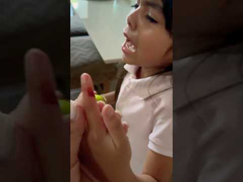 Mi hija se cortó el dedo 😱 #shorts #youtubeshorts #video #viralvideo