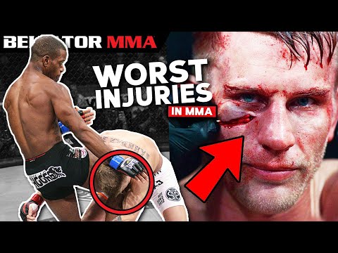 Most GRUESOME Fight Ending Injuries | Bellator MMA