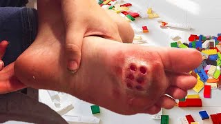 he stepped on a lego then..