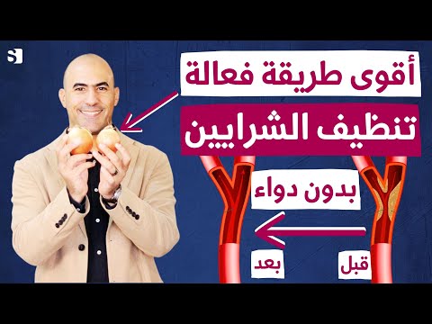 أفضل طريقة لتنظيف الشرايين من الدهون المتراكمة و انسداد الاوعية طبيعيا بدون دواء