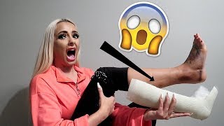 MY CAST WAS REMOVED IN AN EMERGENCY.