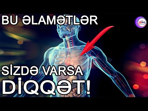 Ciddi xəstəliklərdən xəbər verən əlamətlər    DİQQƏT!