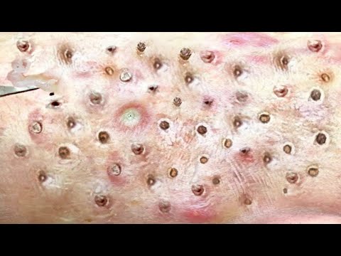 Most Satisfying and Relaxation with An Spa Video #2117