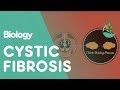 Cystic Fibrosis Genetics and Treatment