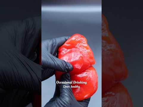 Alcohol and your liver