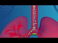 Understanding Asthma
