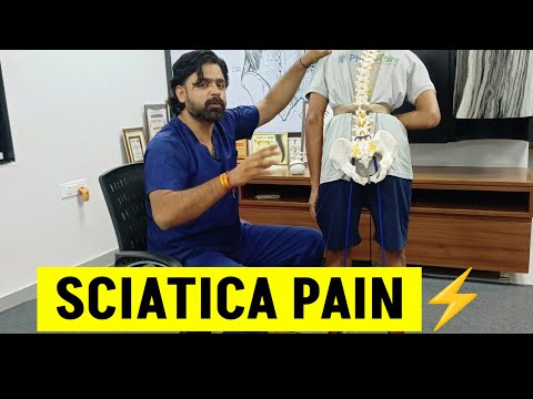 SCIATICA pain | साइटिका दर्द क्या होता है | नसों का दर्द | क्यों होती है पैर में झनझनाहट, सुन्नपन