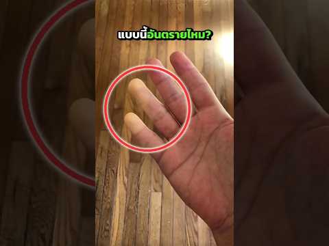 อาการ "เรนอซซินโดรม" #สาระ #shorts