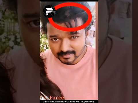 Interesting Facts | Unknown Facts Malayalam | #shorts #ytshorts