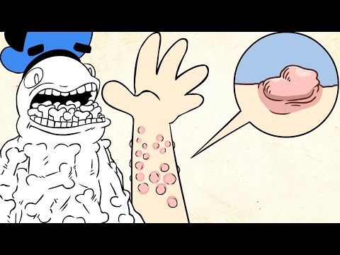 What Happens If You're Allergic To Water? | SPD Q&A #060