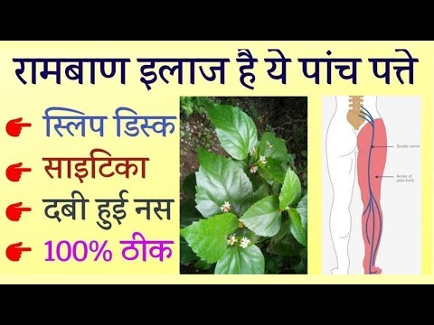 शर्त लगालो दबी हुई नस, साइटिका, Slip Disc Pain होगा 100% ठीक, sciatica dard, nason ke dard ka ilaj