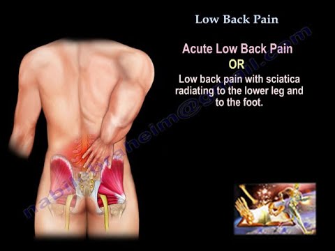 ​Low Back Pain: Causes, Symptoms, Diagnosis, and Treatment