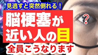 脳梗塞が近い人だけに起こる「目の異変」見逃すと突然倒れます！