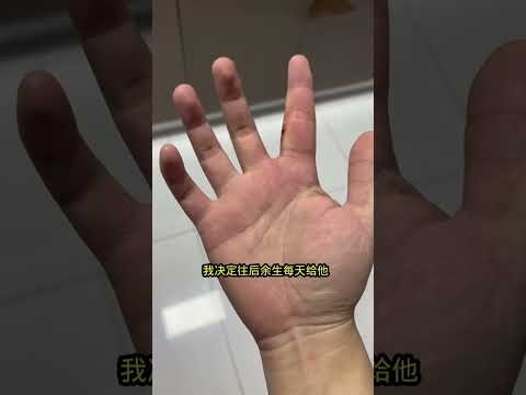 被章魚咬手，為什麼屁股會痛#Shorts