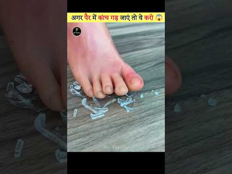 Glass in Your Foot 😱