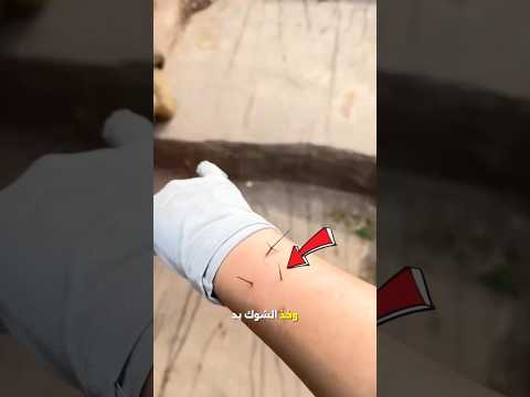 طلبت المساعدة من القرد 🙏