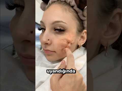 Yüzünde Bunu GÖRÜRSEN, Hemen Yardım Çağır❗️😨