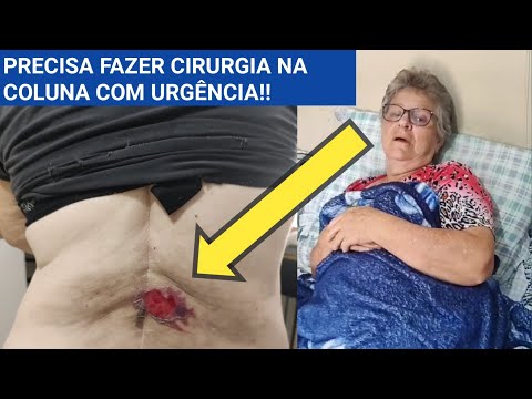 Cirurgia de Urgência, Dona Marlene Vieira Pede Ajuda Para uma Cirurgia na Coluna !!!