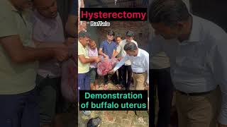 Hysterectomy l Demonstration of uterus l dr Umar Khan
