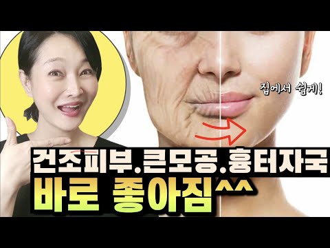 피부가 너무 좋아졌다고 난리예요~집에서 하는 백만원 피부과 시술✔️