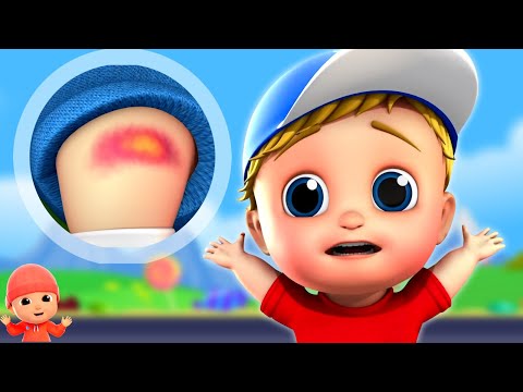 Boo Boo Song, बू बू गीत, Bimar Geet + Hindi Rhymes for Children and Balgeet for Kids, Sick Song