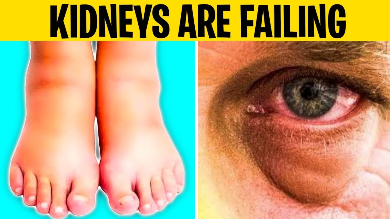 7 Warning Signs Your Kidneys Are About To Fail
