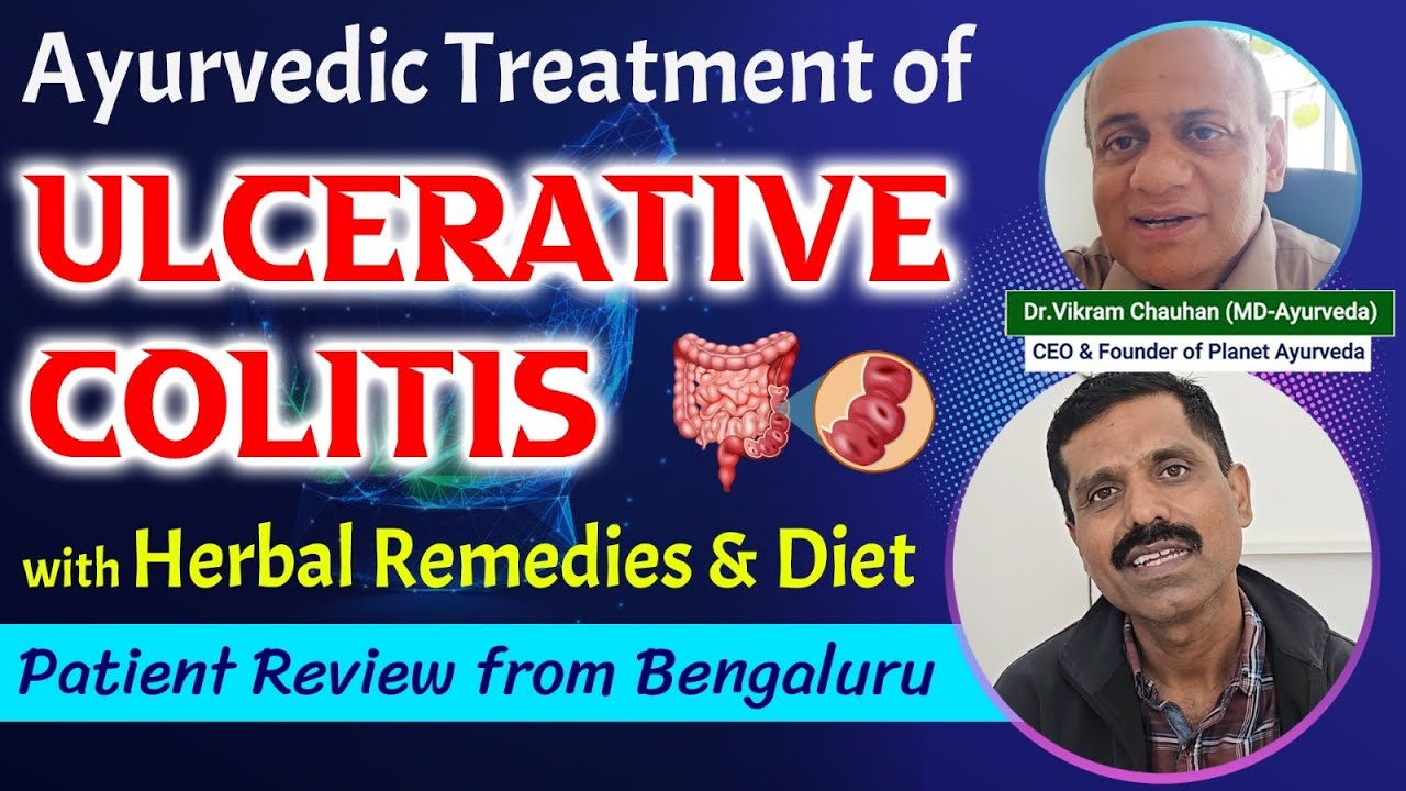 Watch Video Ayurvedic Treatment of Ulcerative Colitis with Herbal Remedies & Diet| Patient Review from Bengaluru