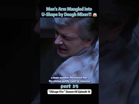 Man's Arm Mangled into U-Shape by Dough Mixer?! 😱【Part 25】