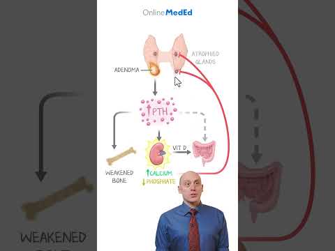 Decoding Hyperparathyroidism: How to Tell Primary from Secondary on Labs & Clinically