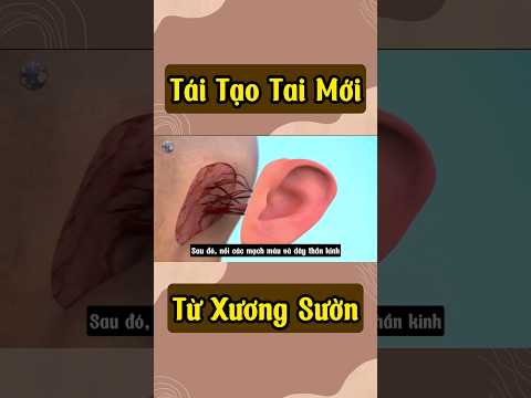 Tái Tạo Tai Mới Từ Xương Sường#youtubeshorts