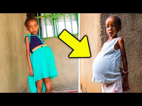 Ela Estava Grávida com 6 Anos. O Que Aconteceu a Seguir Fará Você Chorar