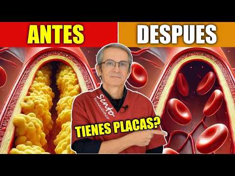 ¿Tus ARTERIAS están en RIESGO? Descubre la PRUEBA que Puede Salvar tu CORAZÓN 💓