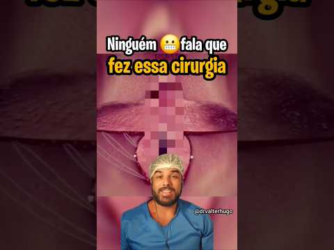 CIRURGIÃO 😲MOSTRA RESULTADO CIRURGIA ÍNTIMA! OLHA ANTES E DEPOIS COMO FICOU!!! #ninfoplastia #labios