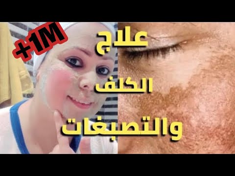 وأخيرا أنجح وصفة طبيعية الإزالة الكلف والبقع الداكنة من الوجه وتوحيد لون البشرة