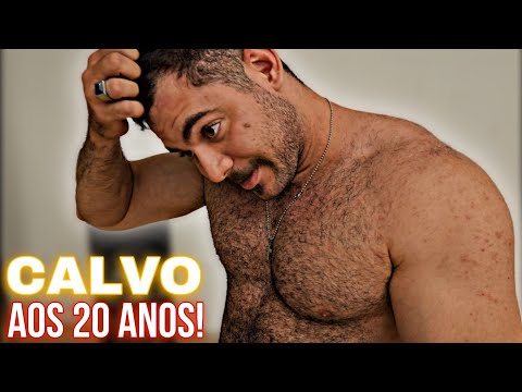 Usei HORMÔNIOS com 20 Anos... Deu Ruim!