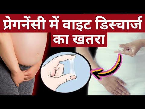 प्रेगनेंसी में WHITE डिस्चार्ज के ख़तरे से बचे - white discharge in pregnancy - Youtube mom