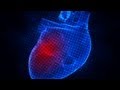 Innovative Treatment for Aortic Dilation