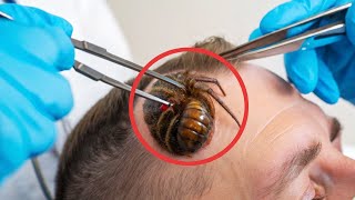 100 Insectos Más Venenosos del Mundo