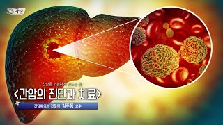 [TV메디컬약손]20241105(754회) 간담을 서늘하게 만드는 병 '간암의 진단과 치료'_칠곡경북대학교병원 간담췌외과 김주동 교수 다시보기