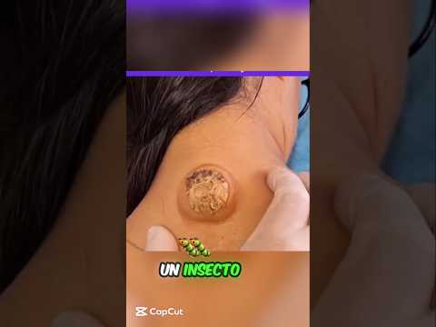 Un insecto lo mordió en el cuello #historia shorts #história #historiaespañola #hospital #insecto