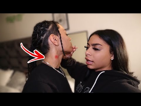 HICKEY PRANK ON GIRLFRIEND