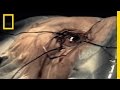 Vision Restoration and Retinitis Pigmentosa